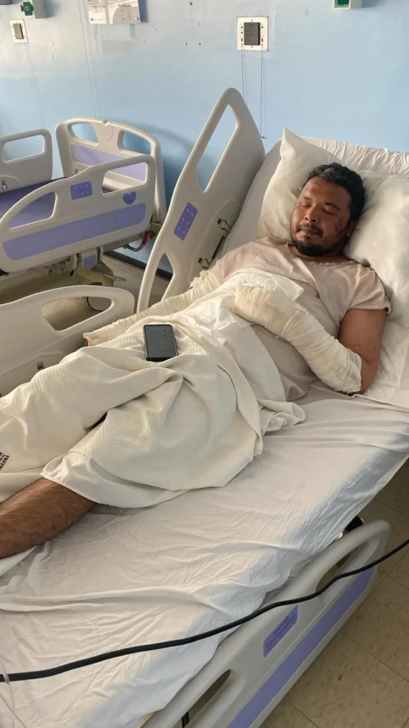 Enrique Linares Jr. está asilado en el hospital con quemaduras de segundo grado en sus brazos, además registra fuertes golpes