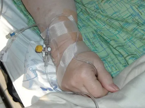 Ecuador registra el primer caso de eutanasia en mujer con cáncer