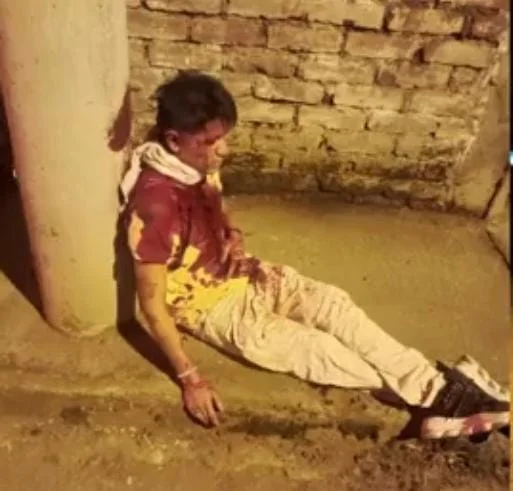 Joven baleado en Guanujo fue llevado sin ambulancia