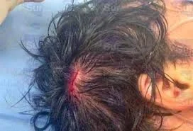 Ambato hombre recibió un palazo en la cabeza.