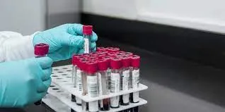 IESS entregó muestra de sangre con nombre equivocado en Quito