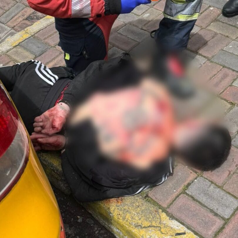 Mujer recibió varios disparos de su pareja en Quito