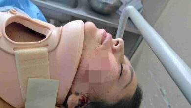 Una madre y su hija fueron atropelladas en accidente de tránsito, y su recuperación bordea los 7.000 dólares