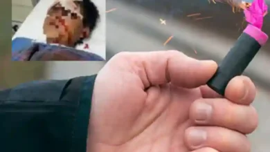 Un niño de 11 años de edad resultó quemado por jugar con pirotecnia en Riobamba. Al momento se encuentra en el Hospital Docente