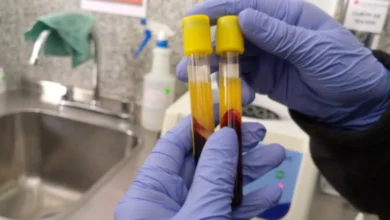 Cruz Roja Cotopaxi realiza exámenes VIH y VDRL a bajo costo