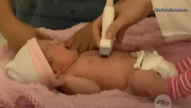 Bebé nació embarazada y le hicieron cesárea tras 24 horas de vida