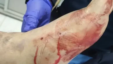 Adulto mayor de 78 años atacado por culebra en Pallatanga