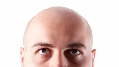 Día Mundial de los Calvos, un homenaje a quienes lucen su cabeza rapada