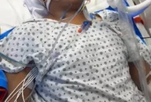 Joven de Alausí se debate entre la vida y la muerte