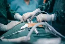 Niño muere en cirugía por su médico que estaba distraído con el celular