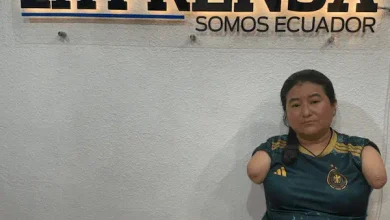 Silvia pide ayuda para conseguir prótesis de brazos