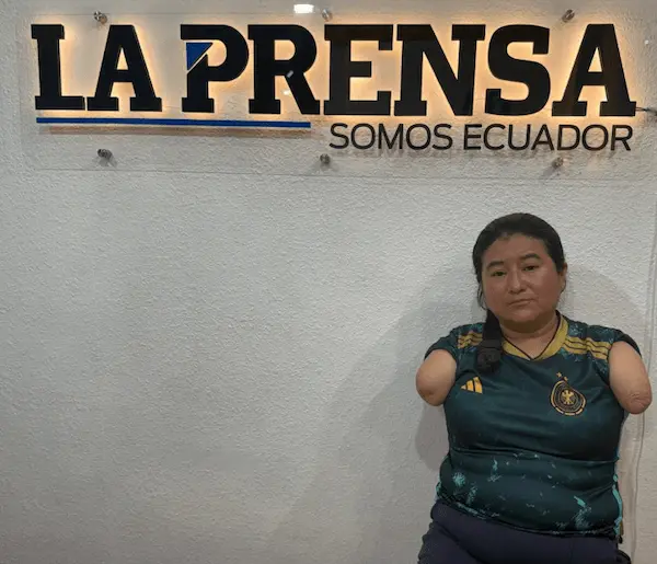 Silvia pide ayuda para conseguir prótesis de brazos