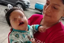 Madre busca ayuda para cirugía de su bebé con labio leporino